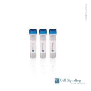 ANTICORPO PROTOR-2 (D19A5) RABBIT MAB - uniscience